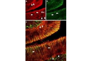 Expression of CNGA2 in rat cerebellum - Immunohistochemical staining of rat cerebellum using Anti-CNGA2 Antibody (ABIN7043090, ABIN7044955 and ABIN7044956). (CNGA2 antibody  (C-Term, Intracellular))