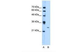 Image no. 1 for anti-Transmembrane Protein 126B (TMEM126B) (AA 141-190) antibody (ABIN321580) (TMEM126B antibody  (AA 141-190))
