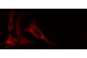 ABIN6274660 staining Hela cells by IF/ICC. (CYP4X1 antibody)