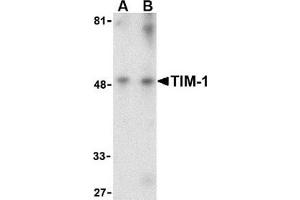 Western blot analysis of TIM-1 in human uterus tissue lysate with this product at (A) 1 and (B) 2 μg/ml. (HAVCR1 antibody  (Center))
