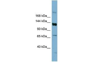 WB Suggested Anti-ABCB4 Antibody Titration:  0. (ABCB4 antibody  (Middle Region))