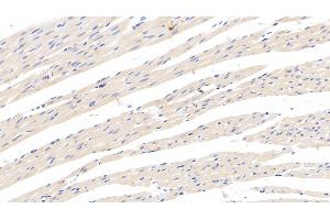 Detection of CRHBP in Rat Cardiac Muscle Tissue using Monoclonal Antibody to Corticotropin Releasing Hormone Binding Protein (CRHBP) (CRHBP antibody  (AA 25-322))