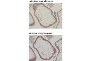 Immunohistochemistry (IHC) image for anti-CD274 (PD-L1) (Extracellular Domain) antibody (ABIN1449244) (PD-L1 antibody  (Extracellular Domain))