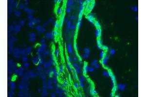 Image no. 3 for anti-Actin, alpha 2, Smooth Muscle, Aorta (ACTA2) antibody (ABIN335372) (Smooth Muscle Actin antibody)