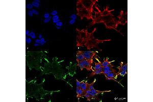 Immunocytochemistry/Immunofluorescence analysis using Mouse Anti-Alpha B Crystallin Monoclonal Antibody, Clone 1A7. (CRYAB antibody  (PerCP))