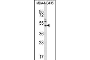 P16 Antibody  (ABIN390140 and ABIN2840644) western blot analysis in MDA-M cell line lysates (35 μg/lane). (MMP16 antibody  (N-Term))