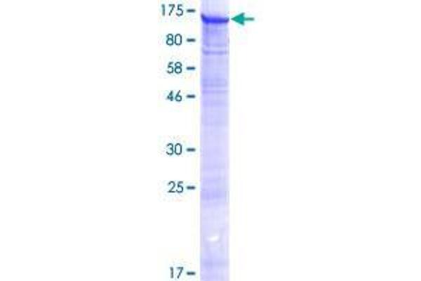 CMTR1 Protein (AA 1-835) (GST tag)