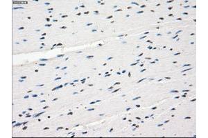 Image no. 5 for anti-Fc gamma RII (CD32) antibody (ABIN1497256) (Fc gamma RII (CD32) antibody)