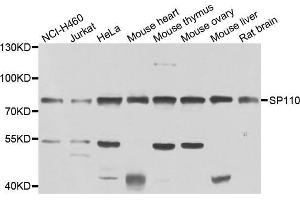 Western blot analysis of extracts of various cell lines, using SP110 antibody (ABIN5975571) at 1/1000 dilution. (SP110 antibody)