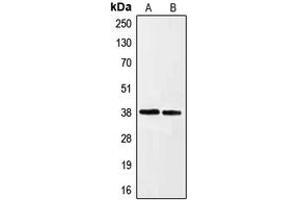 Western blot analysis of Ephrin A3 expression in HeLa (A), HepG2 (B) whole cell lysates. (Ephrin A3 antibody  (C-Term))