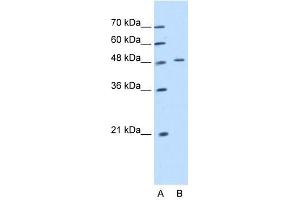 Cytokeratin 20 antibody used at 1. (KRT20 antibody  (Middle Region))