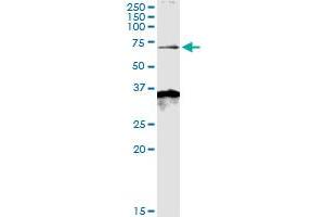 Immunoprecipitation of MKKS transfected lysate using anti-MKKS MaxPab rabbit polyclonal antibody and Protein A Magnetic Bead , and immunoblotted with MKKS purified MaxPab mouse polyclonal antibody (B01P) . (MKKS antibody  (AA 1-570))