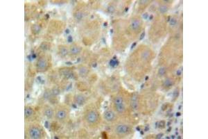#VALUE! (Factor XI antibody  (AA 170-398))