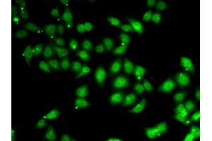 Immunofluorescence analysis of U2OS cells using AFF1 antibody. (AF4 antibody)