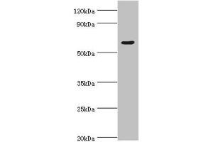 Western blot All lanes: TATA box-binding protein-associated factor RNA polymerase I subunit B antibody at 4 μg/mL + Hela whole cell lysate Secondary Goat polyclonal to rabbit IgG at 1/10000 dilution Predicted band size: 69, 61, 40 kDa Observed band size: 69 kDa (TAF1B antibody  (AA 369-588))