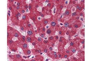 Immunohistochemistry (IHC) image for anti-Methylenetetrahydrofolate Dehydrogenase (NADP+ Dependent) 1, Methenyltetrahydrofolate Cyclohydrolase, Formyltetrahydrofolate Synthetase (MTHFD1) (Middle Region) antibody (ABIN2782515)