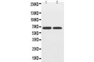 Anti-GLUT12 antibody, Western blotting Lane 1: PC-12 Cell Lysate Lane 2: A549 Cell Lysate (GLUT12 antibody  (Middle Region))