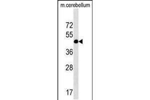 Western blot analysis in mouse cerebellum tissue lysates (35ug/lane). (RQCD1 antibody  (AA 106-134))