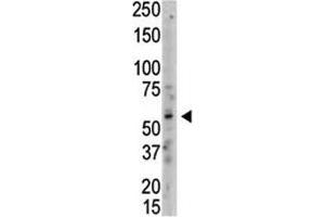 Western blot analysis of PRMT3 antibody and whole HL-60 cell lysate.