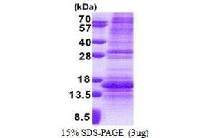 SDS-PAGE (SDS) image for Norrie Disease (Pseudoglioma) (NDP) (AA 25-133) protein (His tag) (ABIN6387274)
