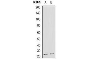 Western blot analysis of TMBIM4 expression in HepG2 (A), human heart (B) whole cell lysates. (TMBIM4 antibody)