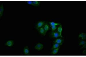 Immunofluorescence staining of HepG2 cells with ABIN7127698 at 1:100,counter-stained with DAPI.