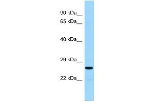 Host:  Rabbit  Target Name:  Akt1s1  Sample Type:  Rat Thymus lysates  Antibody Dilution:  1.