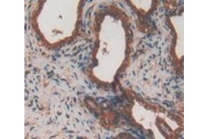 Figure. (AFT1 antibody  (AA 2-240))