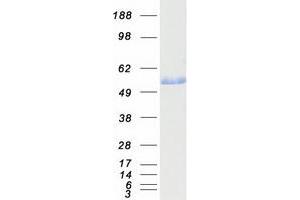 Validation with Western Blot