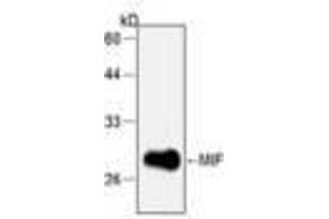 Image no. 1 for anti-Macrophage Migration Inhibitory Factor (Glycosylation-Inhibiting Factor) (MIF) antibody (ABIN791497) (MIF antibody)