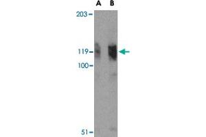 Western blot analysis of FYB in K-562 cell lysate with FYB polyclonal antibody  at (A) 0. (FYB antibody  (N-Term))