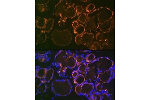Immunofluorescence analysis of mouse thyroid using Parathyroid Hormone (PTH) (PTH) Rabbit mAb (ABIN7269175) at dilution of 1:100 (40x lens). (PTH antibody)