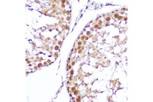 Immunohistochemistry of paraffin-embedded mouse testis using SMOX Rabbit pAb (ABIN6132875, ABIN6148142, ABIN6148143 and ABIN6215369) at dilution of 1:100 (40x lens). (SMOX antibody  (AA 1-200))