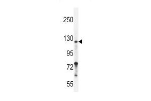 Neuropilin-2 Antibody (C-term ) (ABIN655525 and ABIN2845038) western blot analysis in ZR-75-1 cell line lysates (35 μg/lane). (NRP2 antibody  (C-Term))