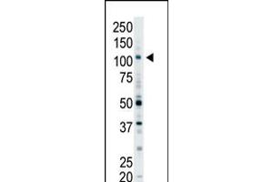 Antibody is used in Western blot to detect EPS15R in Y79 cell lysate.