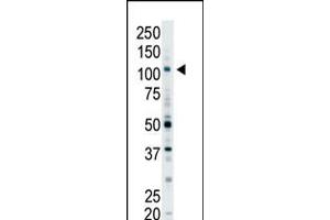 Antibody is used in Western blot to detect EPS15R in Y79 cell lysate. (EPS15 antibody  (N-Term))