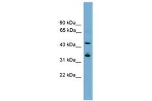 Image no. 1 for anti-Gastrulation Brain Homeobox 1 (GBX1) (AA 51-100) antibody (ABIN6744583) (GBX1 antibody  (AA 51-100))