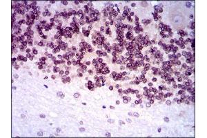 Immunohistochemical analysis of paraffin-embedded cerebellum tissues using NR6A1 mouse mAb with DAB staining.