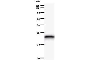 Western Blotting (WB) image for anti-AT Rich Interactive Domain 4A (RBP1-Like) (ARID4A) antibody (ABIN931104) (ARID4A antibody)