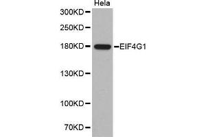 Western Blotting (WB) image for anti-Eukaryotic Translation Initiation Factor 4 Gamma, 1 (EIF4G1) antibody (ABIN1512859) (EIF4G1 antibody)