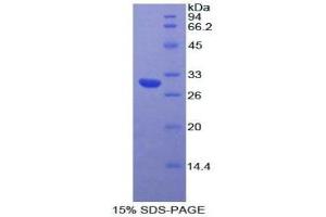 SDS-PAGE (SDS) image for Myosin IA (MYO1A) (AA 781-1043) protein (His tag) (ABIN1878001) (Myosin IA Protein (MYO1A) (AA 781-1043) (His tag))