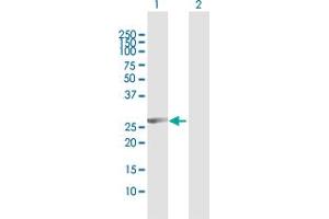Western Blot analysis of CCNB1IP1 expression in transfected 293T cell line by CCNB1IP1 MaxPab polyclonal antibody. (CCNB1IP1 antibody  (AA 1-277))