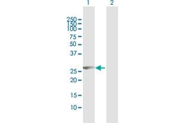 CCNB1IP1 antibody  (AA 1-277)