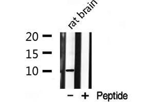 Western blot analysis on rat brain lysate using S100 A1 Antibody (S100A1 antibody  (N-Term))