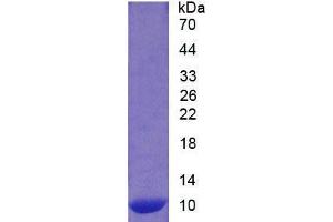 SDS-PAGE analysis of Human S100A12 Protein. (S100A12 Protein)