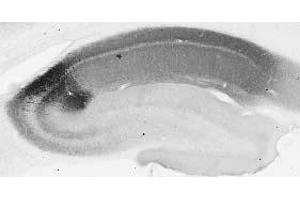 Adult rat hippocampus immunohistochemistry. (RGS14 antibody  (AA 1-544))