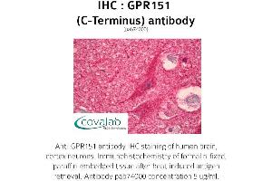 Image no. 1 for anti-G Protein-Coupled Receptor 151 (GPR151) antibody (ABIN1734968) (GPR151 antibody)
