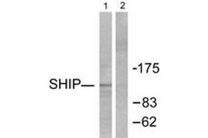 Western blot analysis of extracts from HuvEc cells, using SHIP1 Antibody.