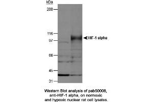 Image no. 2 for anti-Hypoxia Inducible Factor 1, alpha Subunit (Basic Helix-Loop-Helix Transcription Factor) (HIF1A) (AA 432-528) antibody (ABIN363317) (HIF1A antibody  (AA 432-528))