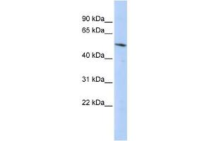 WB Suggested Anti-BCL6B Antibody Titration:  0. (BCL6B antibody  (Middle Region))